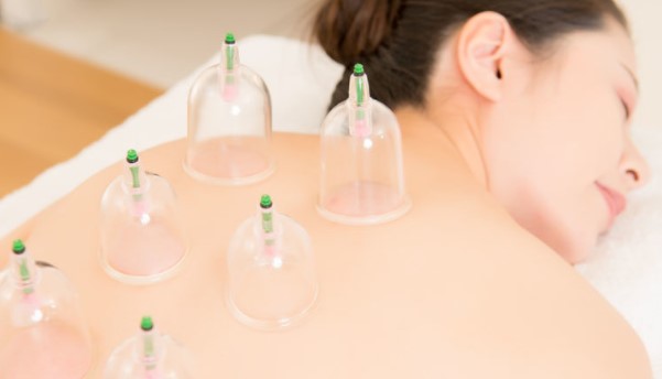 Beginnings of Hijama